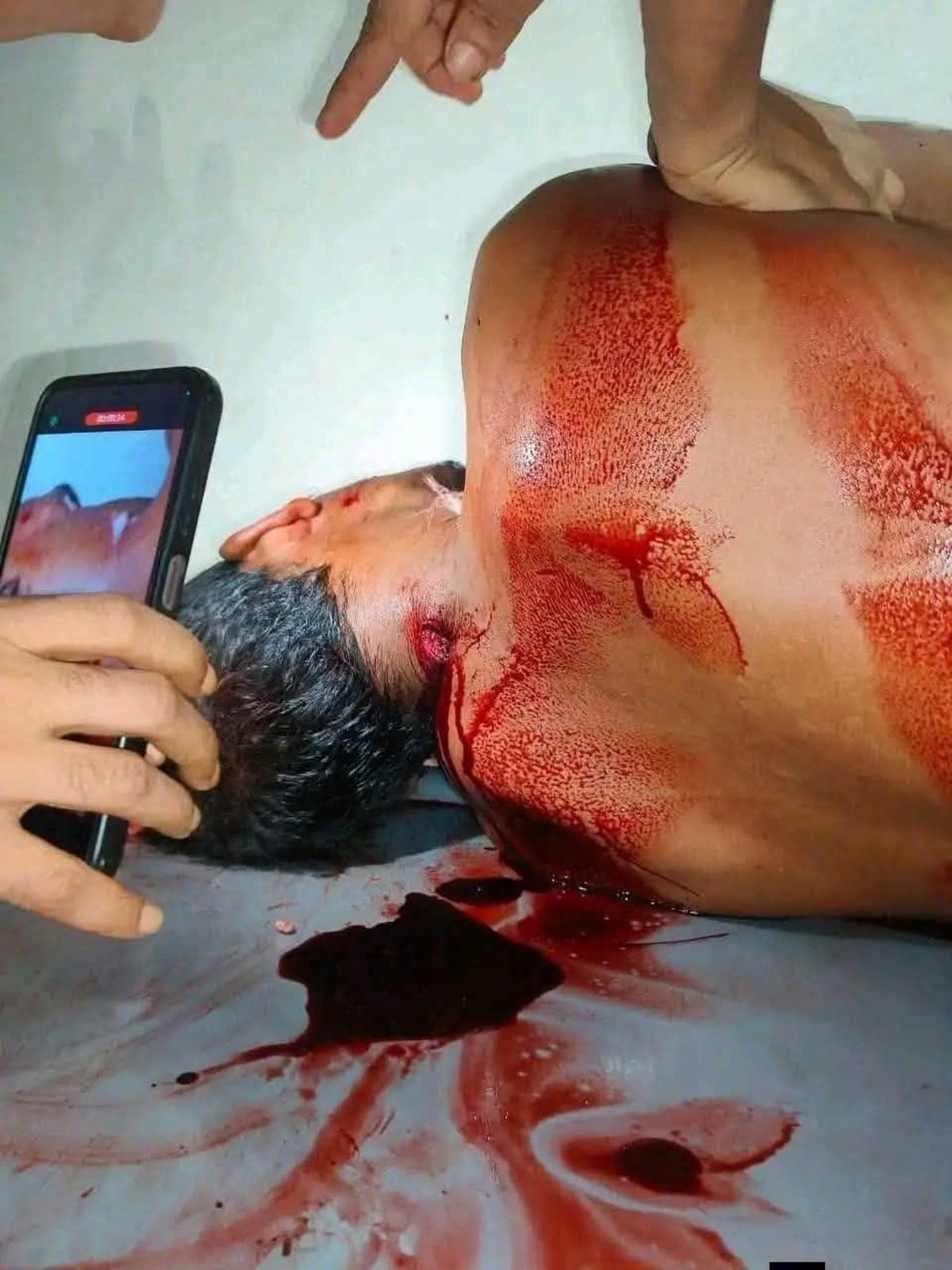 গাইবান্ধায় স্কুল কমিটি নিয়ে দ্বন্দ্ব: বহিষ্কৃত যুবদল নেতার হামলায় শিবির সভাপতির মৃত্যু